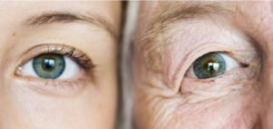 Реабилитация пожилых после катаракты